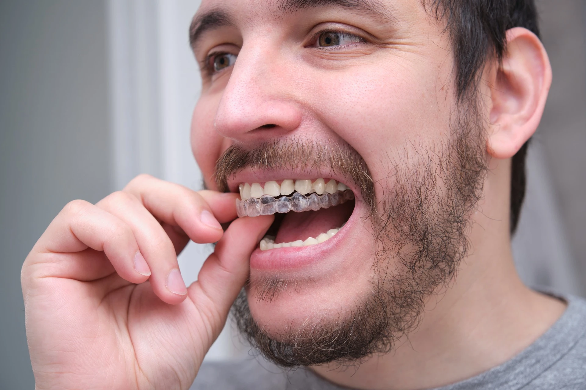 Programa Invisalign Día del Padre