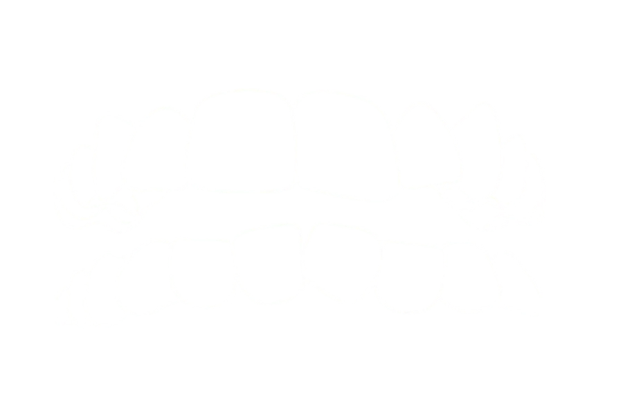 Apiñamiento dental
