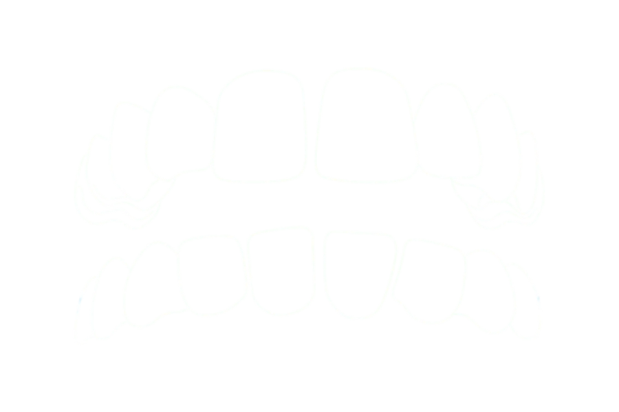 Espacios entre dientes