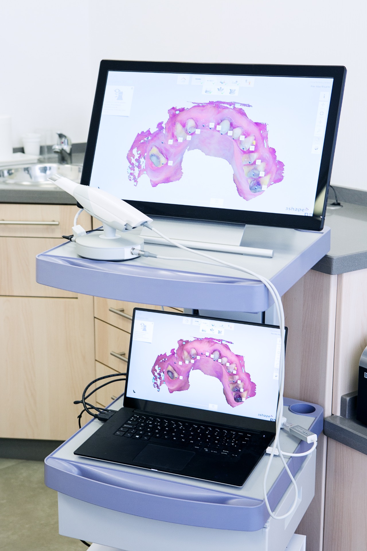 Pantalla de ordenador con modelo dental 3D en clínica sobre mesa de trabajo.